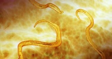 Parasit Pinworm di Tubuh Manusia