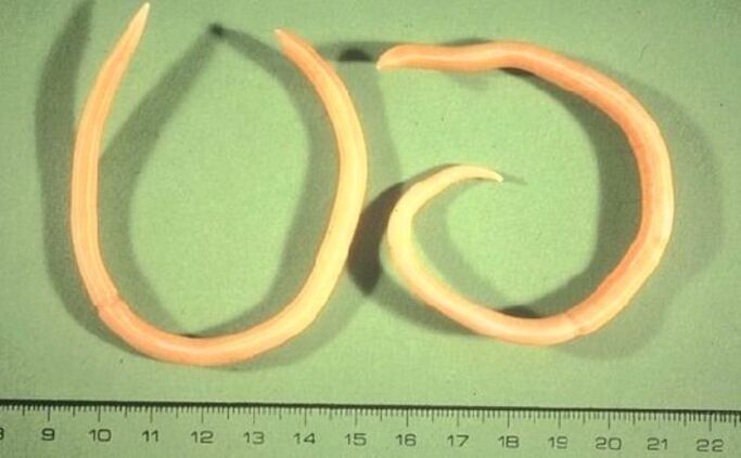 Pinworm dari badan manusia
