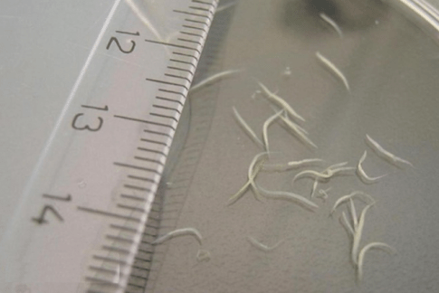 bagaimana untuk membuang pinworms daripada kanak-kanak