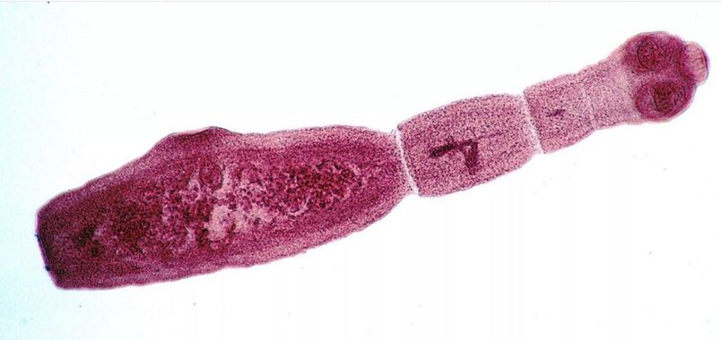 Echinococcus adalah salah satu parasit yang paling berbahaya bagi manusia