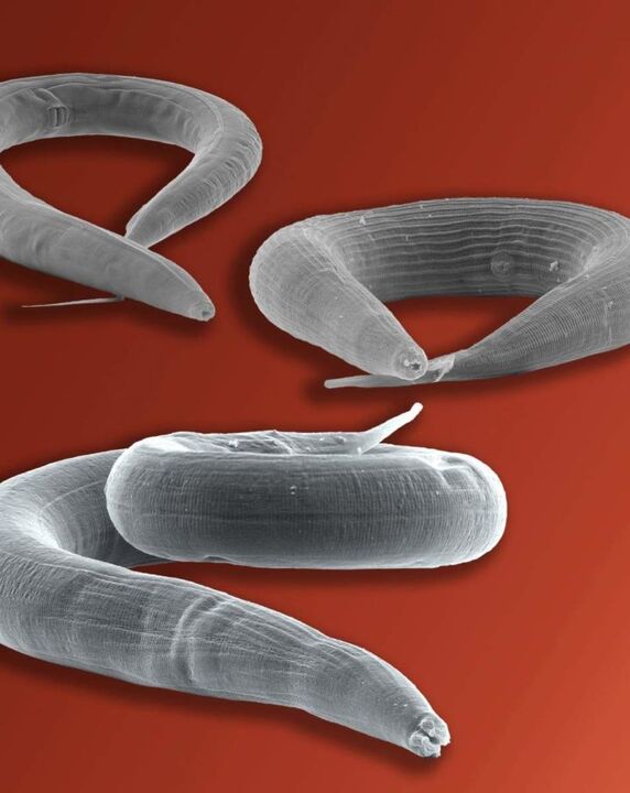 Parasit pinworm yang tinggal di usus
