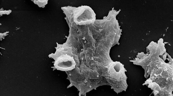 Negleria fowlera ialah parasit unisel yang berbahaya kepada kehidupan manusia. 
