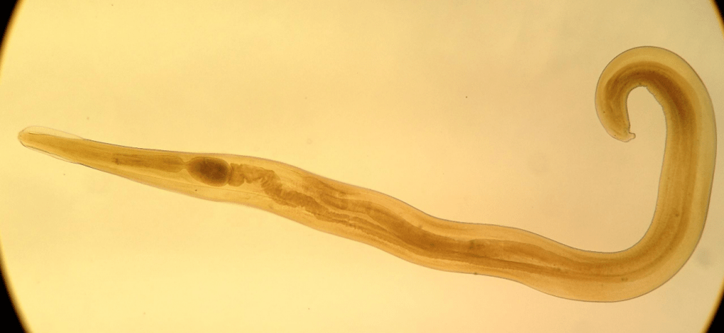 Pinworms adalah parasit biasa pada kanak-kanak. 